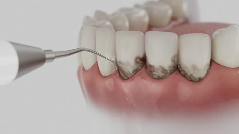 Reliable Dental Implants contractor in Carlsbad, CA by Smile Center Dentistry